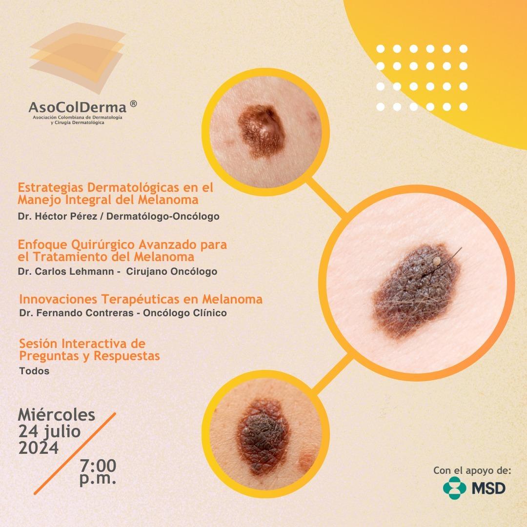 Novedades tratamiento del melanoma 1