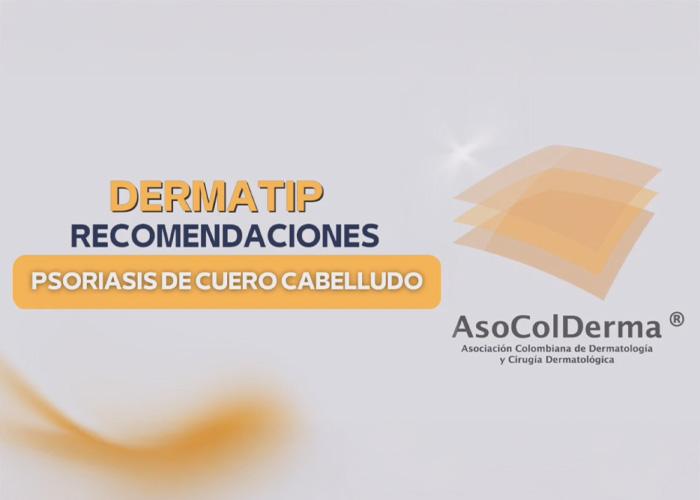 Psoariasis en cuero cabelludo